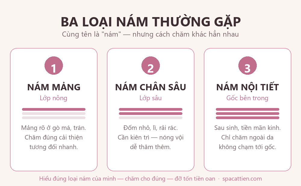 Sơ đồ ba loại nám theo độ sâu trong da